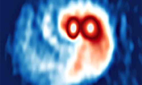 ALMA observations of the circumstellar and circumbinary disks