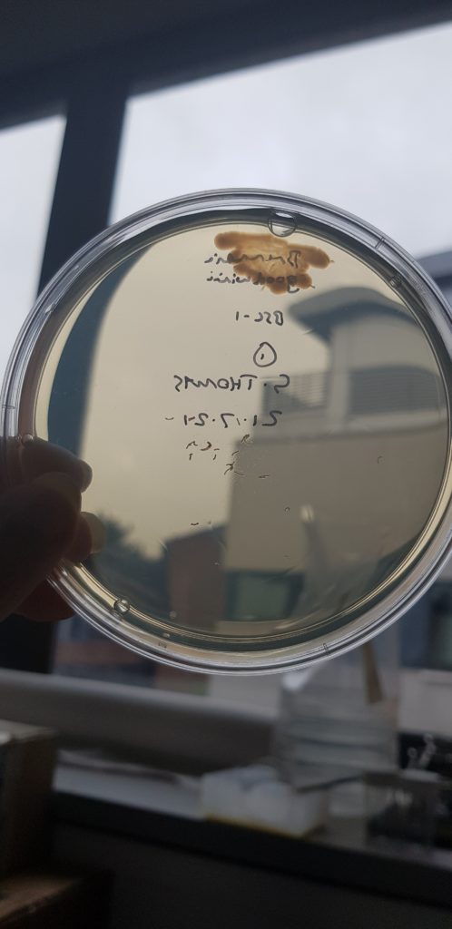Pathogenic bacteria in a petri dish